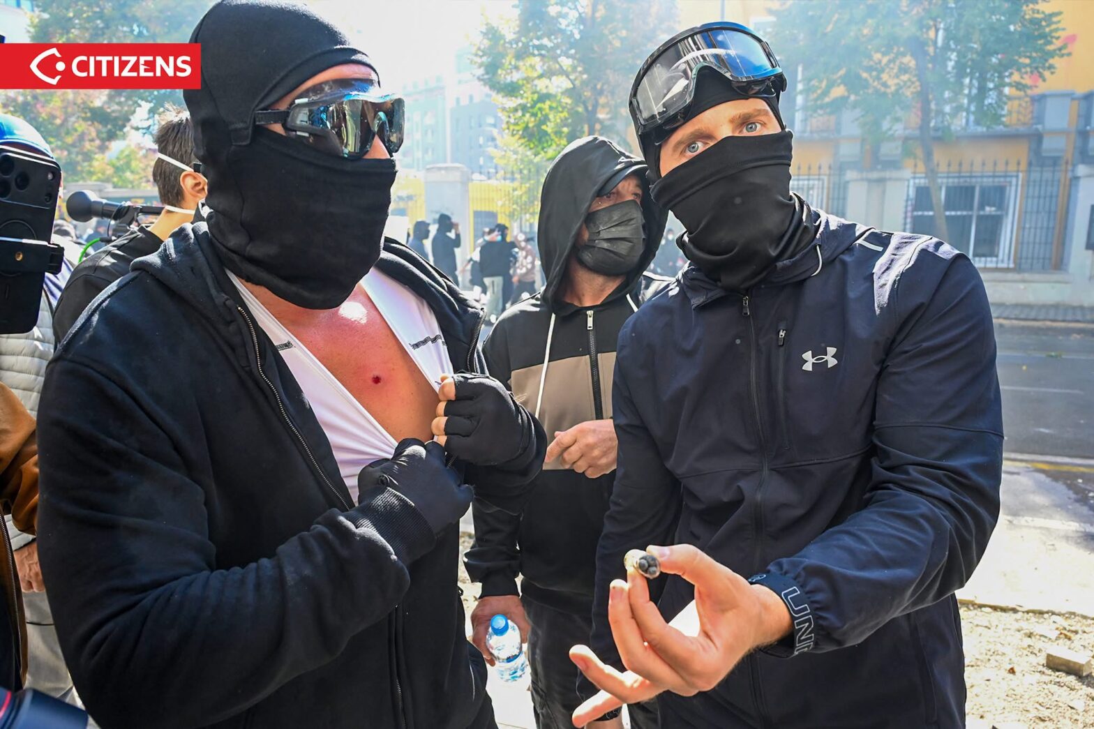 Bloodied Tirana Students Say Police Fired Rubber Bullets 1 IMG 9738